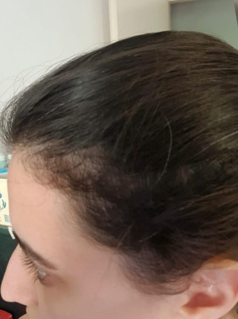 Image #1 from Lamita