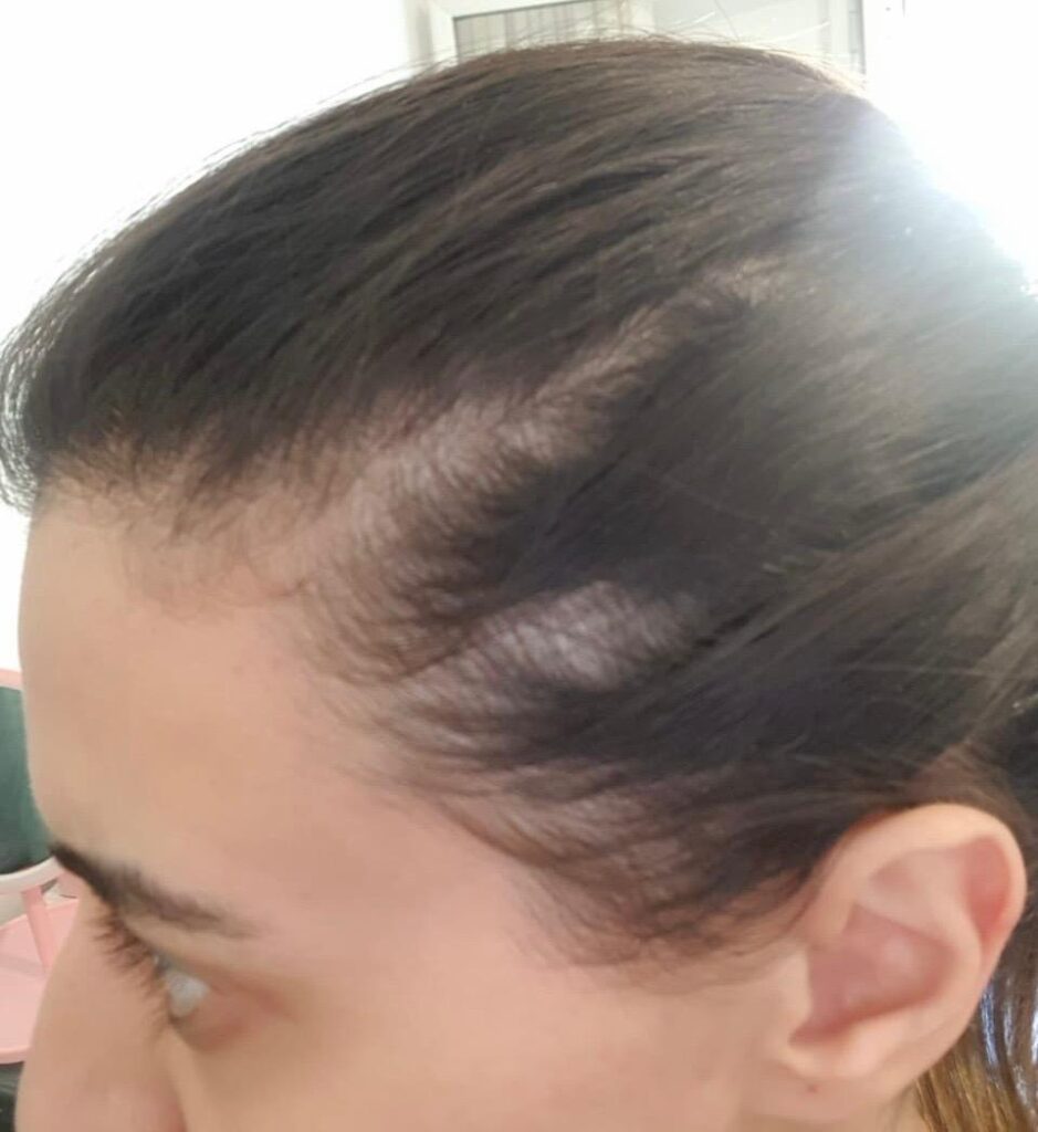 Image #2 from Lamita